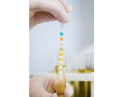 URINE DIPSTICK AS SCREENING TEST FOR PROTEINURIA IN DOGS