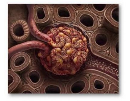 INFECTIOUS DISEASE AND GLOMERULOPATHIES